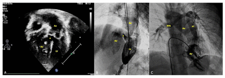 Figure 2: