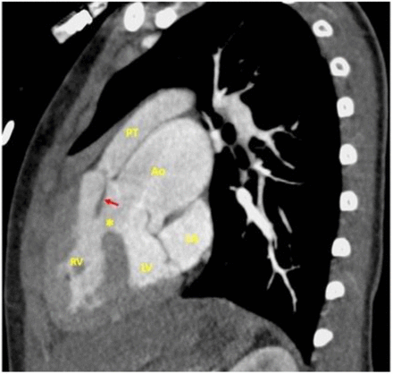 Figure 3: