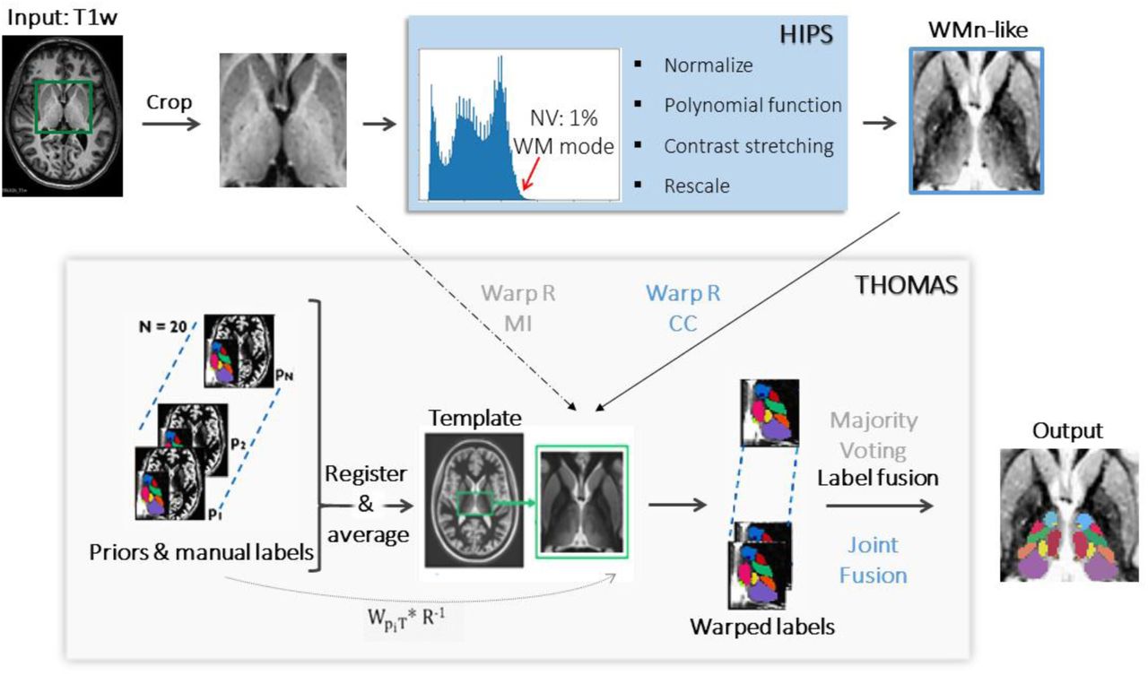 Robust thalamic nuclei segmentation from T1-weighted MRI using polynomial  intensity transformation | medRxiv