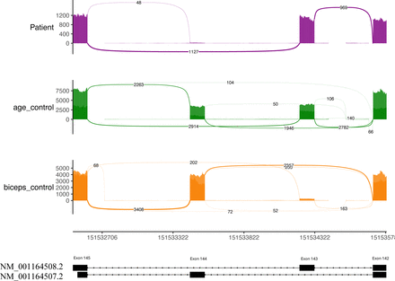 Figure B: