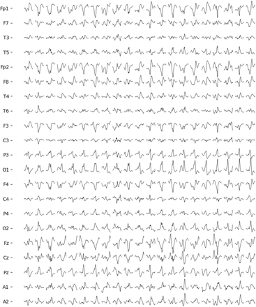 Fig. 10.