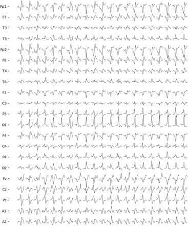 Fig. 11.