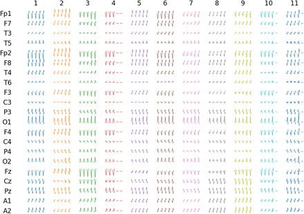 Fig. 13.