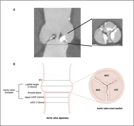 Figure 1: