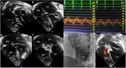 Figure 4: