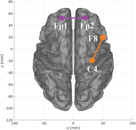 FIG. 10.