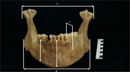 Fig 1a