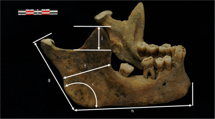 Fig 1b