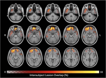 Figure 11: