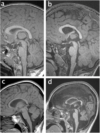 Figure 1a-d.