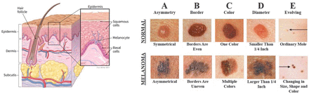 Figure 1: