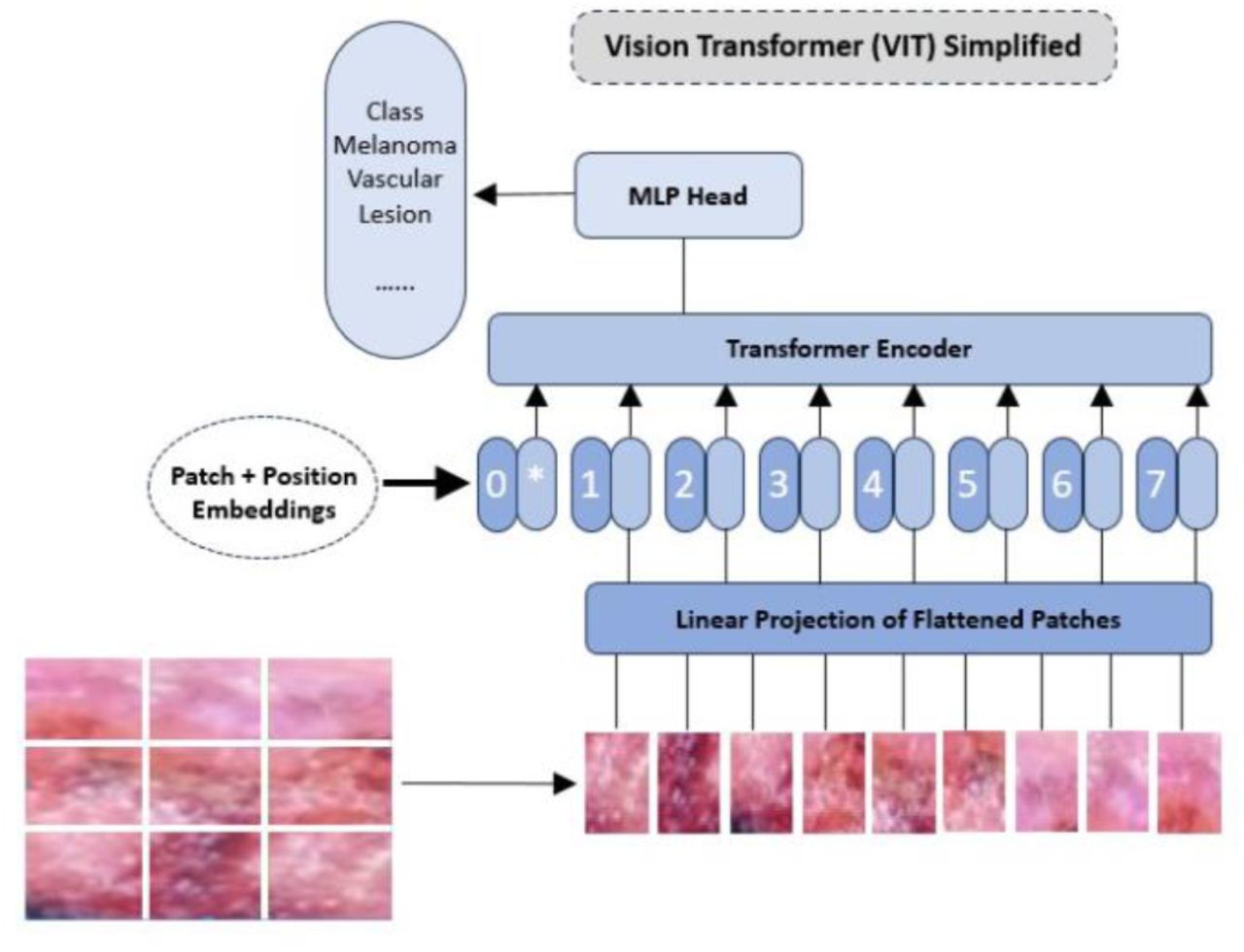 Transformers in Skin Lesion Classification and Diagnosis: A 