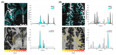 Figure 4: