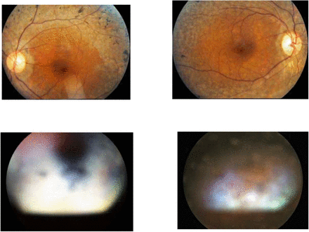 Figure 2: